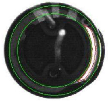 Capacitor Surface Defect Inspection with Machine Vision Lighting sample imaging result